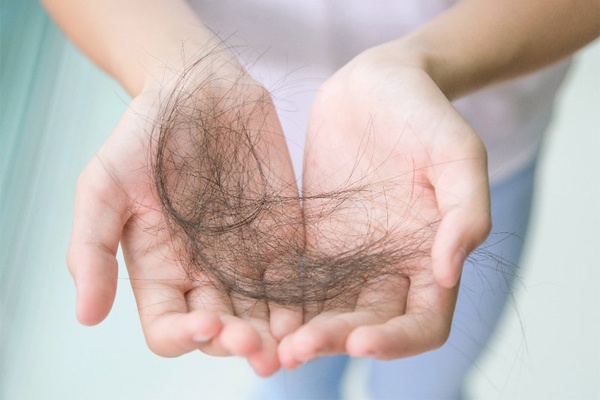 Những nguyên nhân gây ra tình trạng rụng tóc ở cả nam và nữ